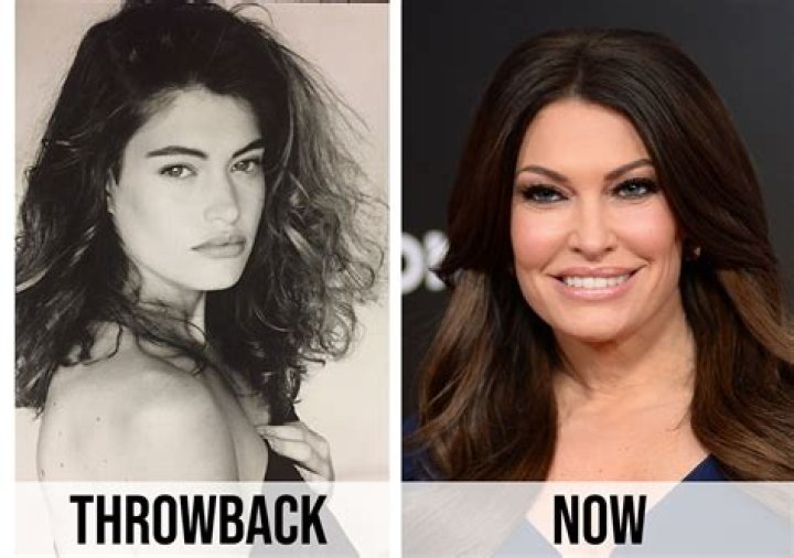 Kimberly Guilfoyle Plastic Surgery A New Youth For News Anchor